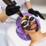 karbon peeling neden yapılır