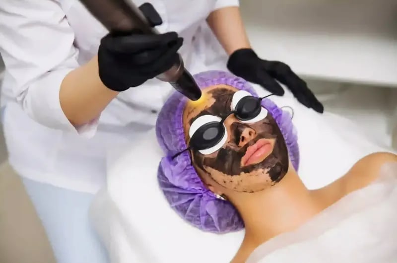 Karbon Peeling Neden Yapılır?