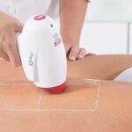lazer epilasyon atış derecesi