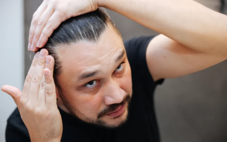 kreatin saç döker mi