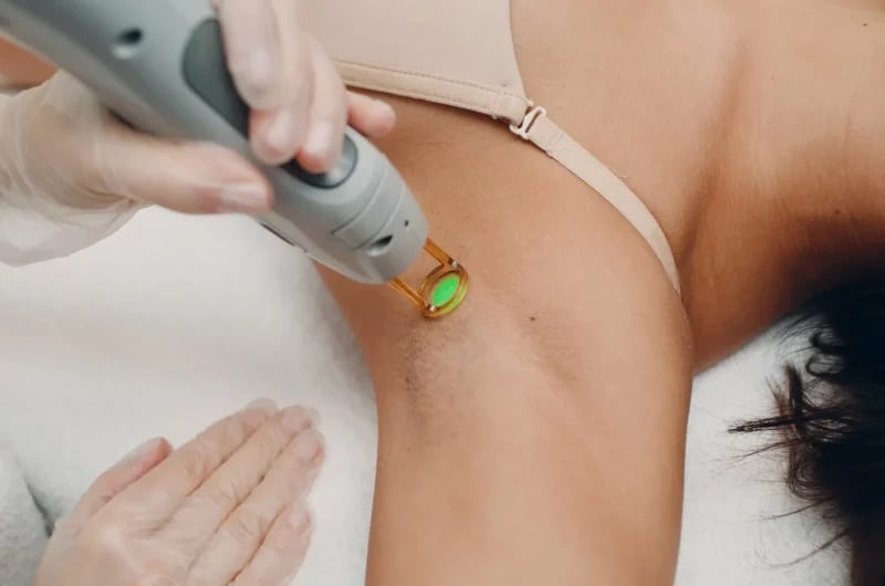 Lazer Epilasyon Kanser Yapar mı? Bilimsel Araştırmalar Ne Diyor?