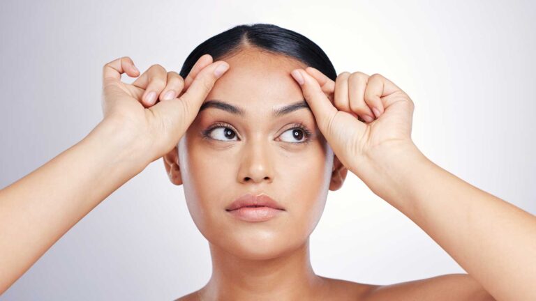 ankara forehead lift