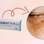 Expigment Krem