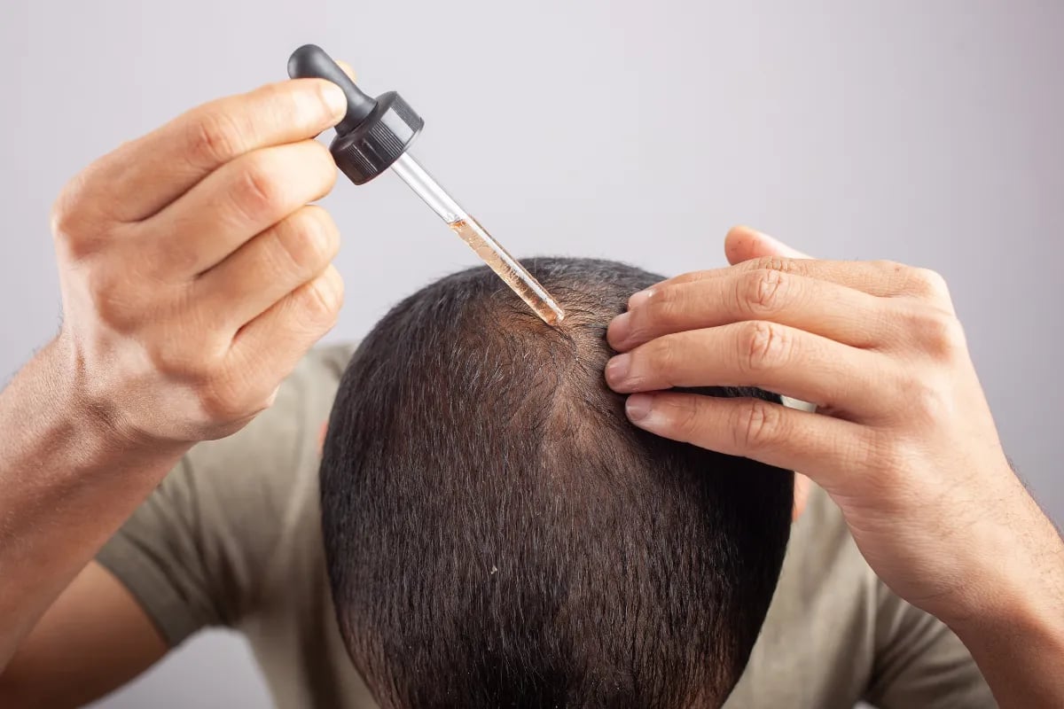 minoxidil minoxidil