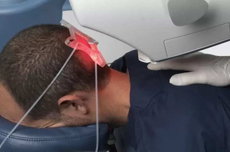 Robotik Saç Ekimi Nedir? Fiyatı, Avantajları ve Başarı Oranı