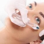 dermapen nedir