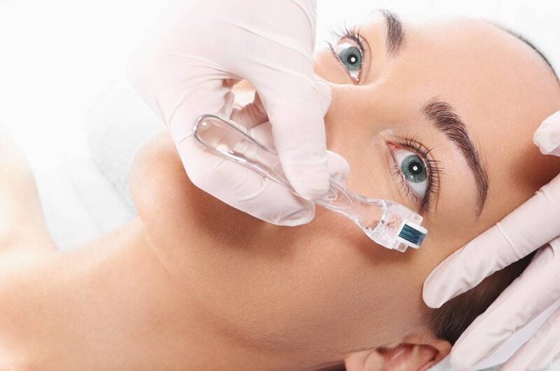 Dermapen Nedir? Uygulama Süreci ve Cilt Sorunları Çözümleri