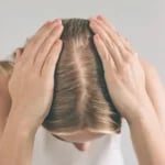 pcos saç dökülmesi