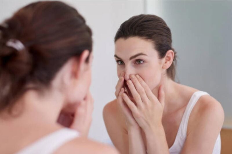 Seboreik Dermatit Belirtileri, Nedenleri ve Tedavi Yöntemleri